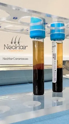 NeoHair Canarias
